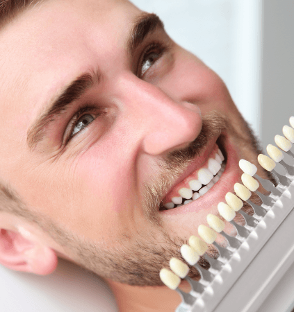 Man's smile compared with teeth whitening chart