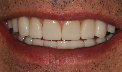 Healthy beautiful smile after cosmetic dentistry