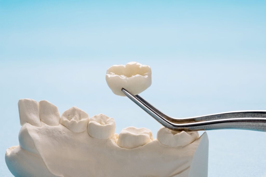 Closeup of dental crown being placed on model teeth with light blue background