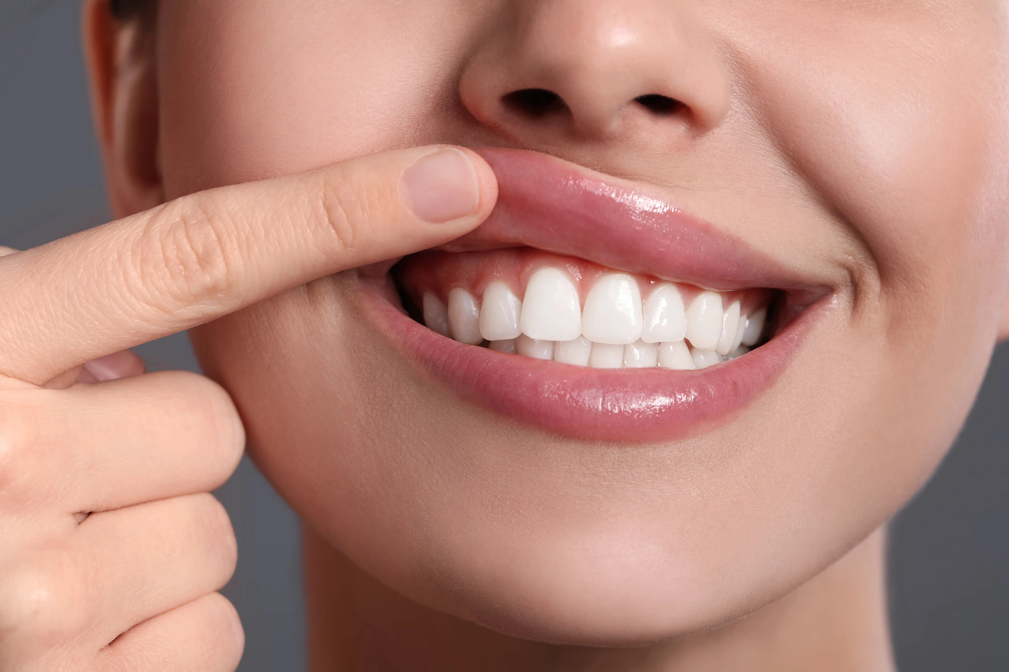 woman-showing-her-gums-and-smiling-gum-disease-treatment-Richmond