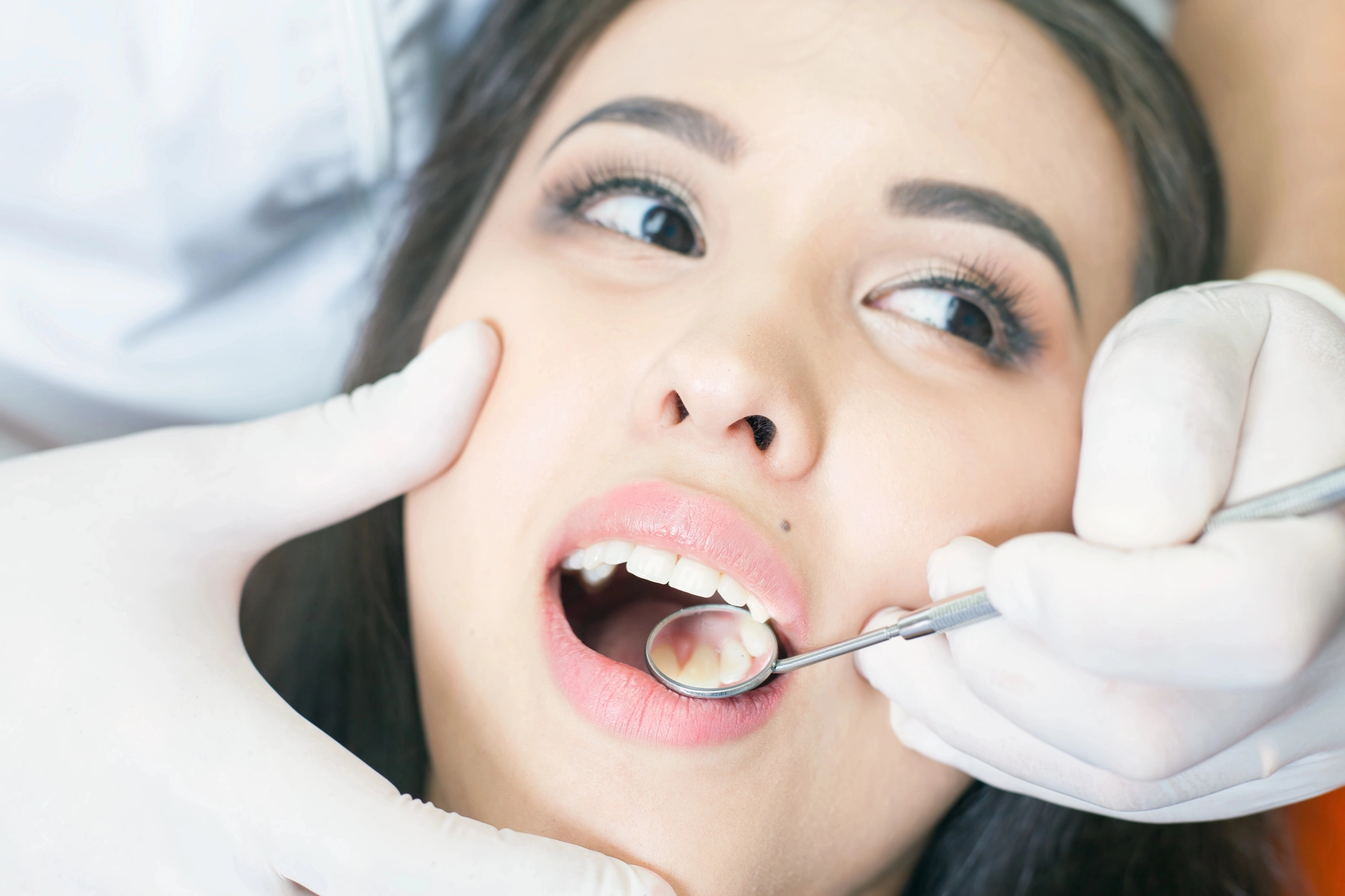 woman-with-mouth-open-at-the-Dentist-Glen-Allen-VA
