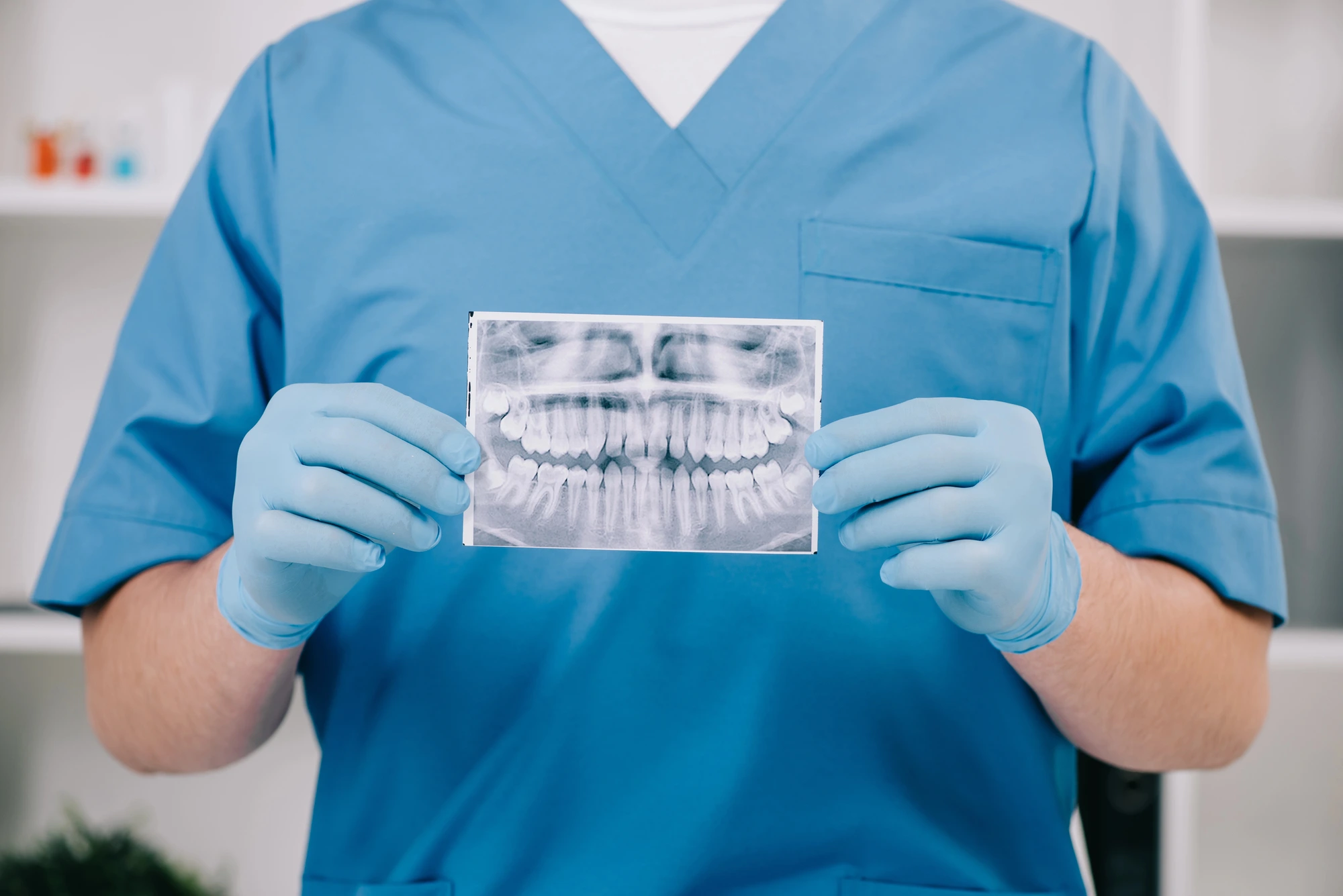 dentist holding xray of mouth Invisalign in Richmond, VA