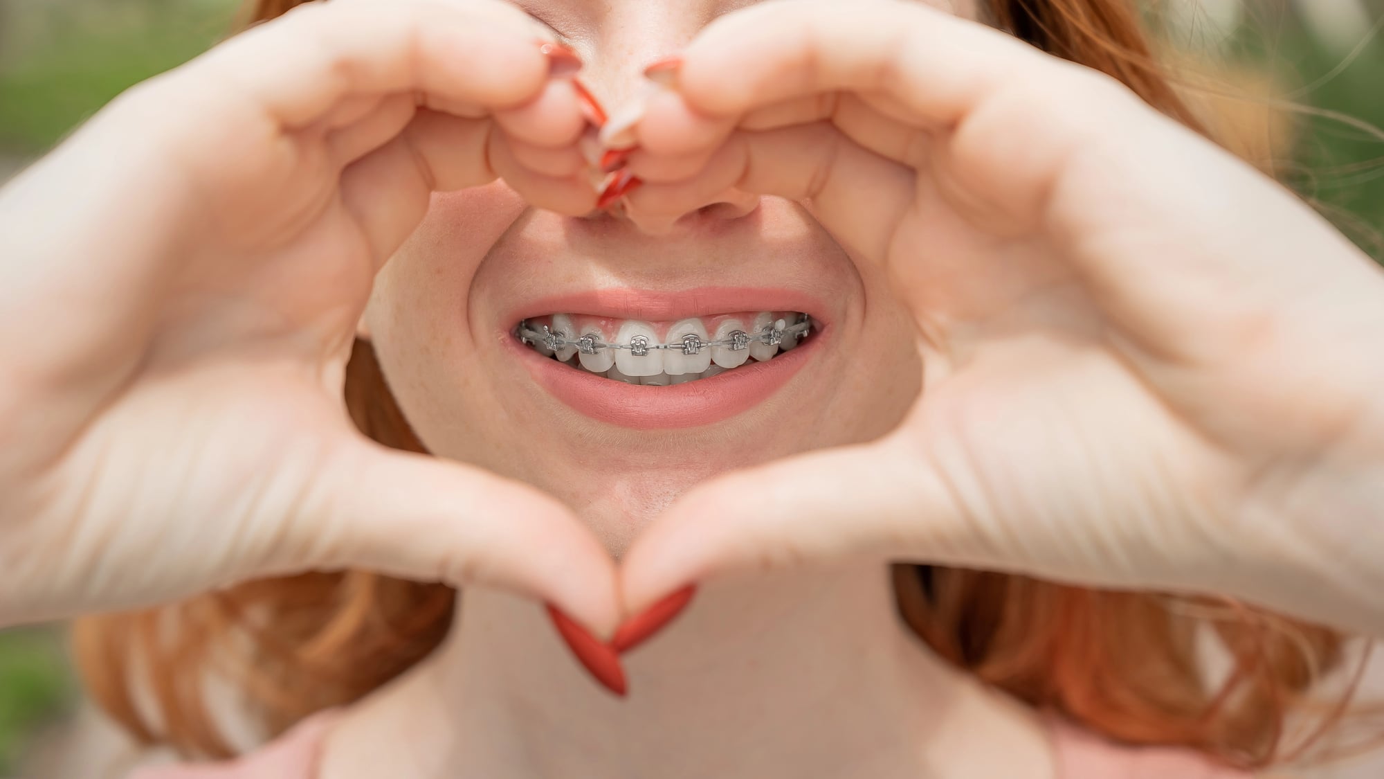 girl making a heart and centering her braces Invisalign in Short Pump VA