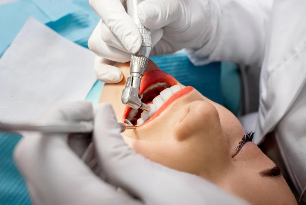 close-up of a a teeth cleaning in Richmond